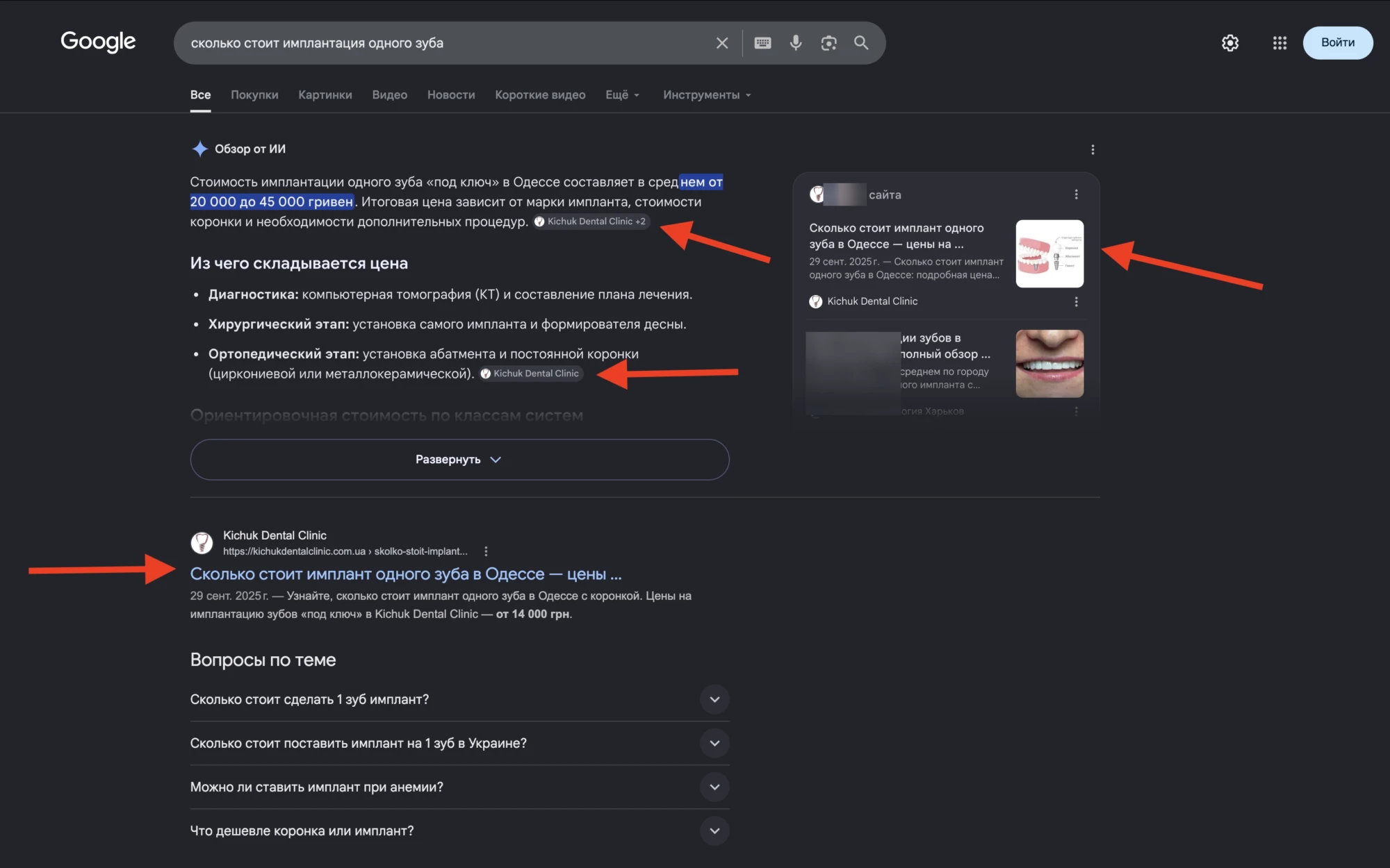 Рекомендація сайту клініки в AI-пошуку (ChatGPT/AI Overview) за запитом "імплантація одного зуба"